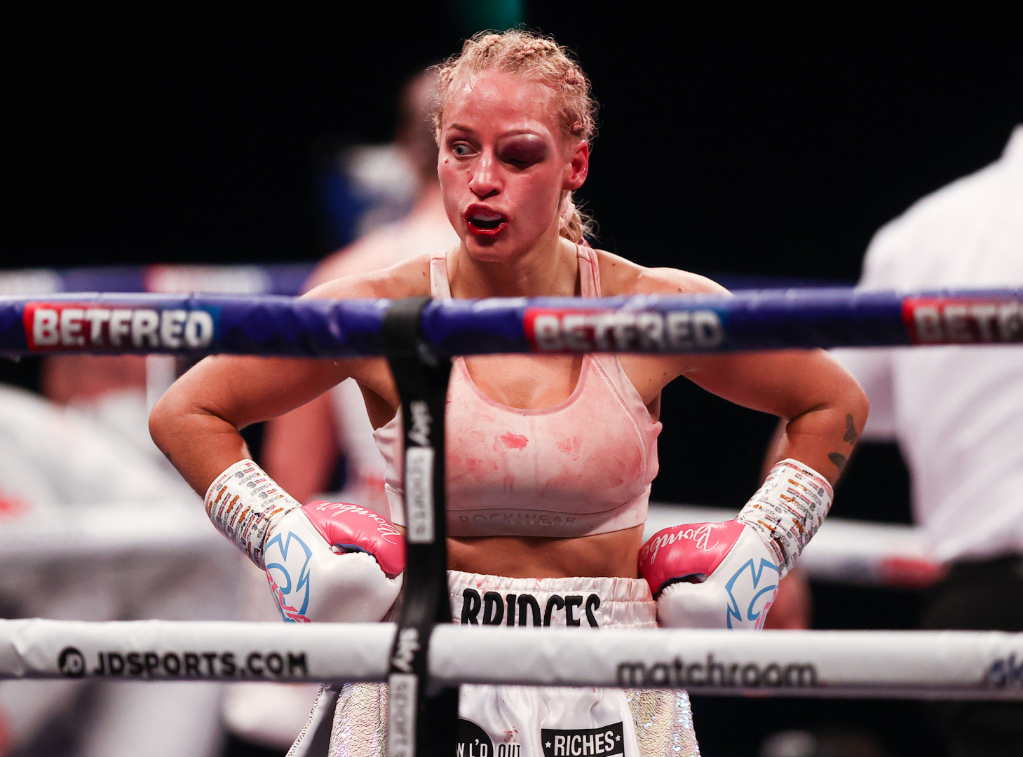 Female boxer stood in the boxing ring with swollen eye and hands on hips.