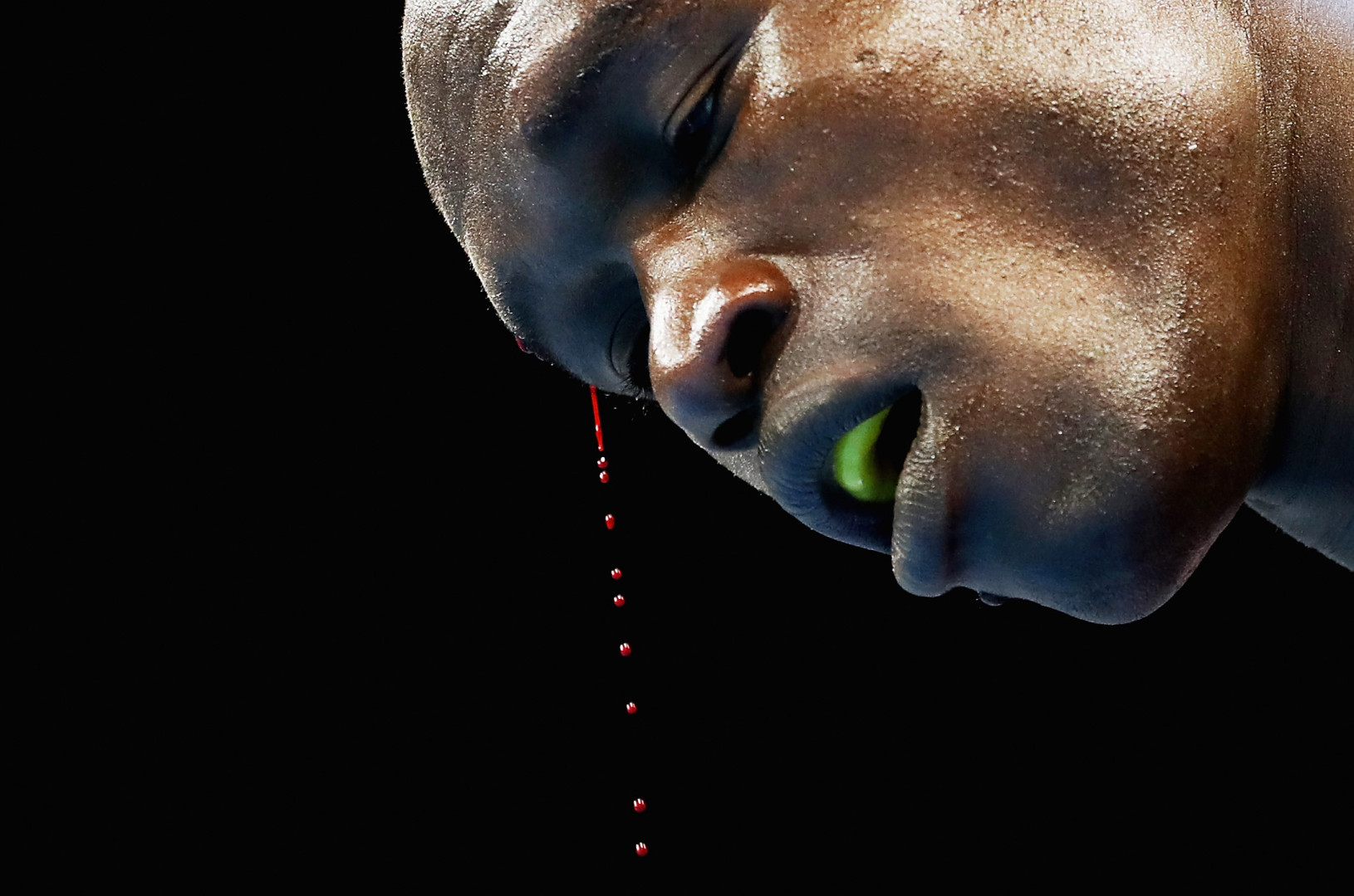Close up head shot of blood dripping from boxer's head.