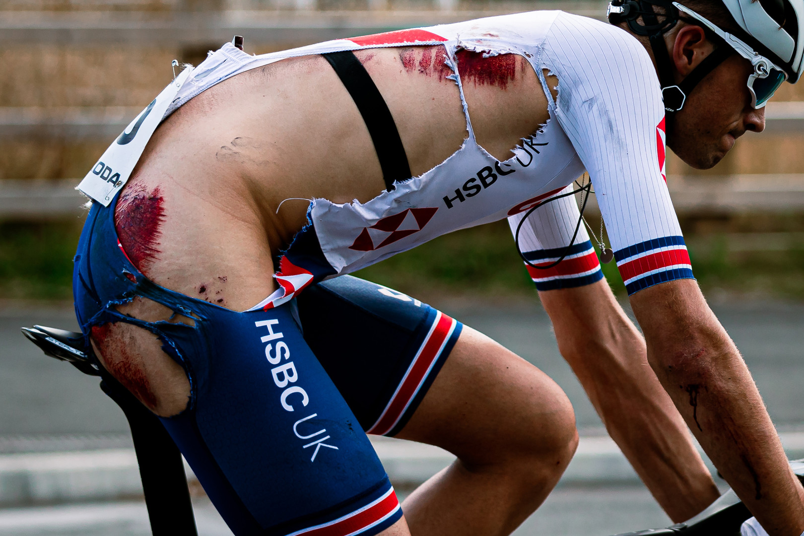 Close up of Ethan Vernon's ripped tri suit reveals bloody gashes to his body during Tour de Britain.