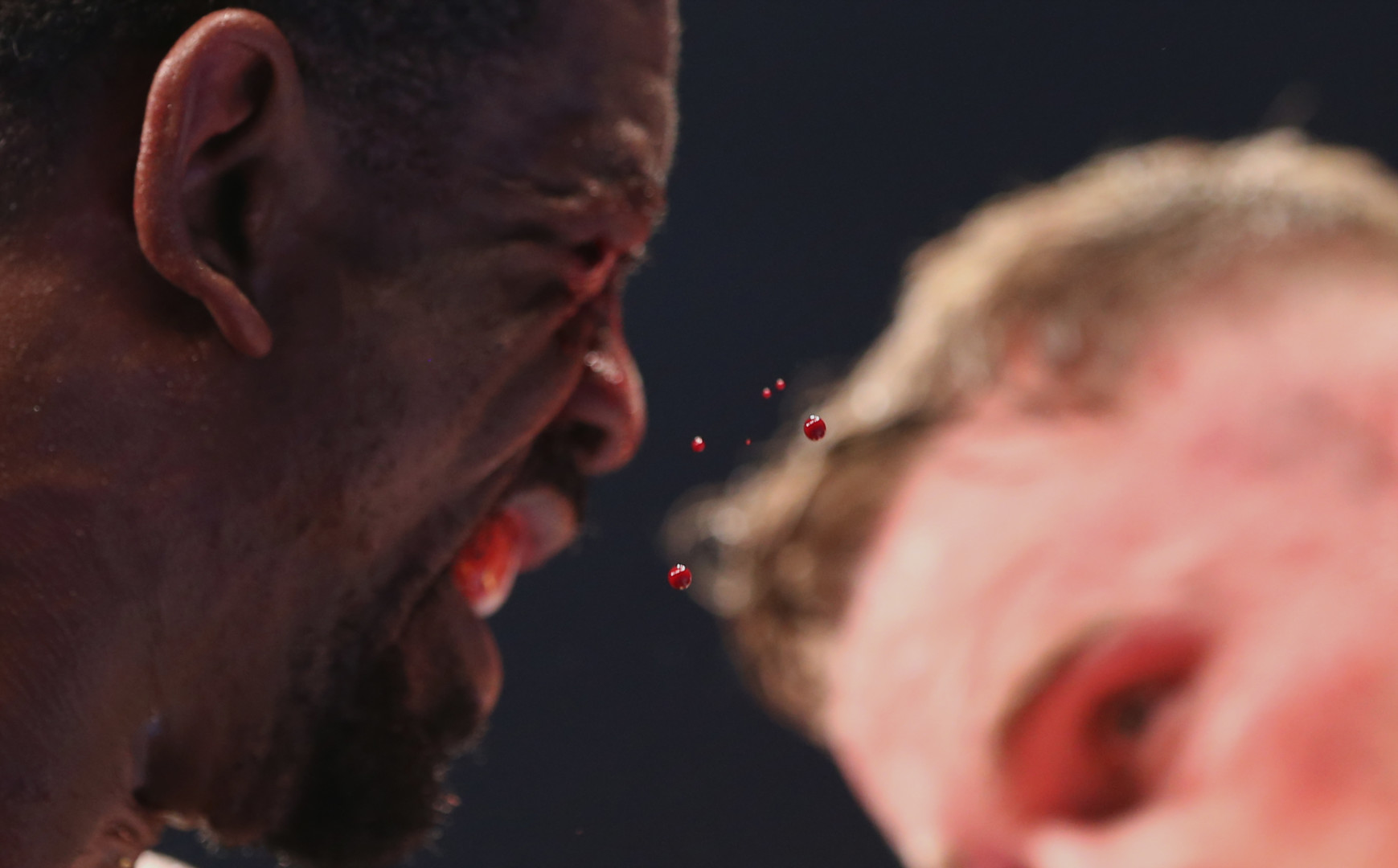 Six droplets of blood in focus from the face of a boxer.
